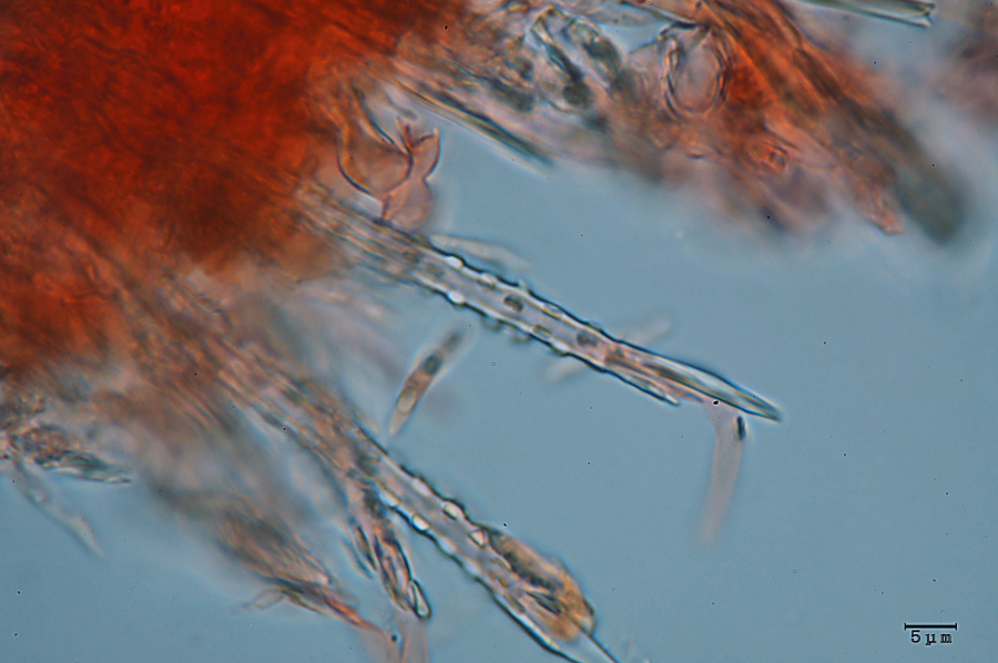Crostina biancastra - foto7460 (Subulicystidium longisporum)